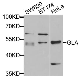 Anti-GLA Antibody from Bioworld Technology (BS7679) - Antibodies.com