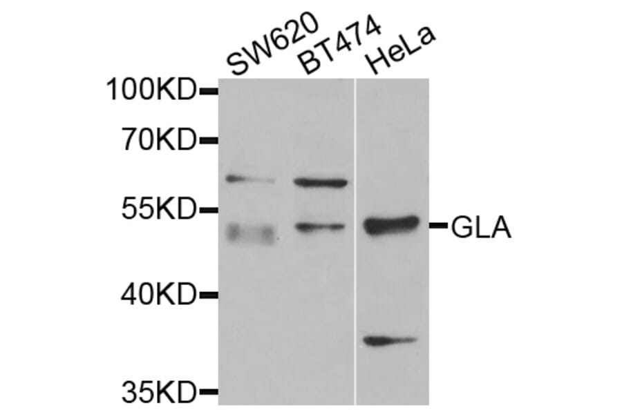 Anti-GLA Antibody from Bioworld Technology (BS7679) - Antibodies.com