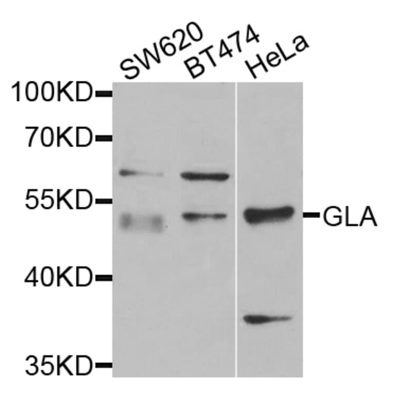 Anti-GLA Antibody from Bioworld Technology (BS7679) - Antibodies.com