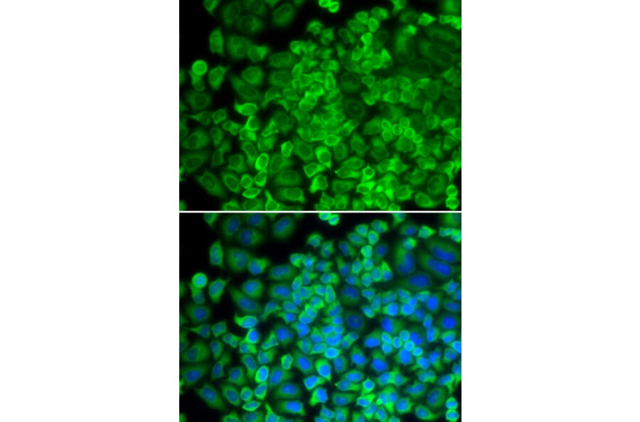 Anti-GLA Antibody from Bioworld Technology (BS7679) - Antibodies.com