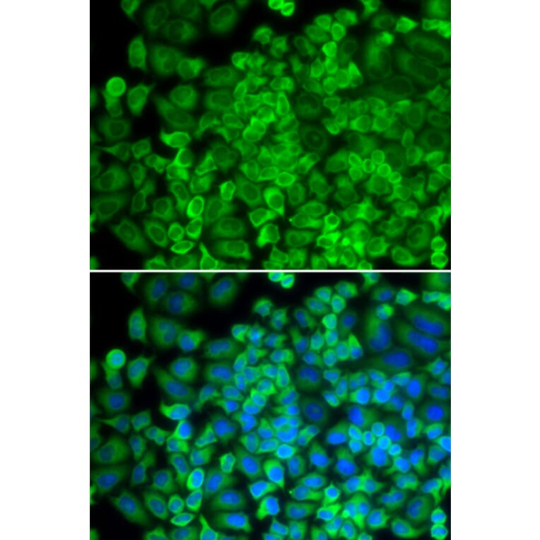 Anti-GLA Antibody from Bioworld Technology (BS7679) - Antibodies.com