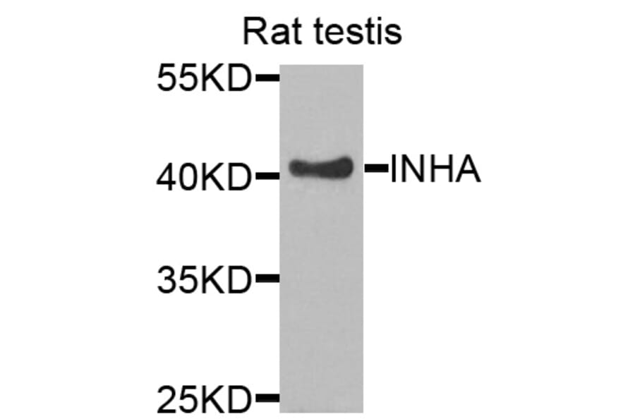 Anti-INHA Antibody from Bioworld Technology (BS7680) - Antibodies.com
