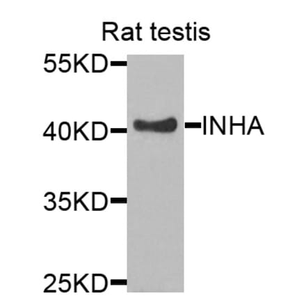 Anti-INHA Antibody from Bioworld Technology (BS7680) - Antibodies.com