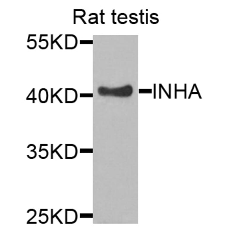 Anti-INHA Antibody from Bioworld Technology (BS7680) - Antibodies.com