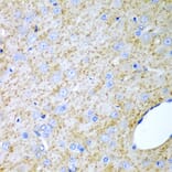 Anti-INHA Antibody from Bioworld Technology (BS7680) - Antibodies.com