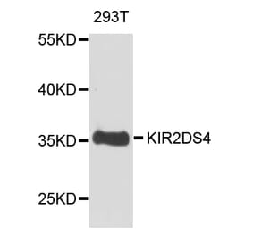 Anti-KIR2DS4 Antibody from Bioworld Technology (BS7683) - Antibodies.com