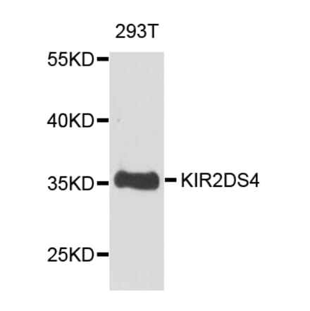 Anti-KIR2DS4 Antibody from Bioworld Technology (BS7683) - Antibodies.com