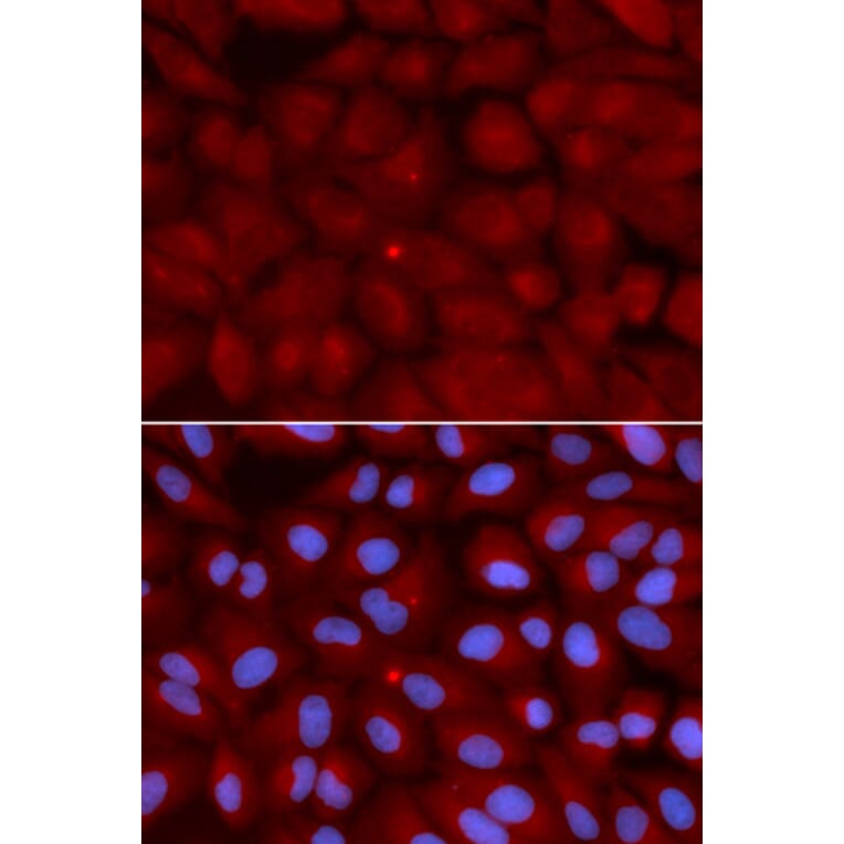 Anti-BIN1 Antibody from Bioworld Technology (BS7684) - Antibodies.com
