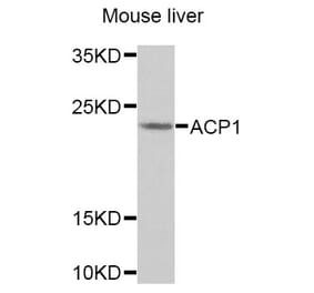Anti-ACP1 Antibody from Bioworld Technology (BS7686) - Antibodies.com