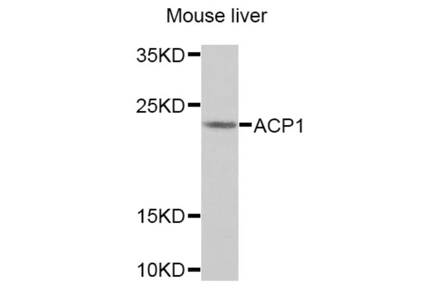 Anti-ACP1 Antibody from Bioworld Technology (BS7686) - Antibodies.com