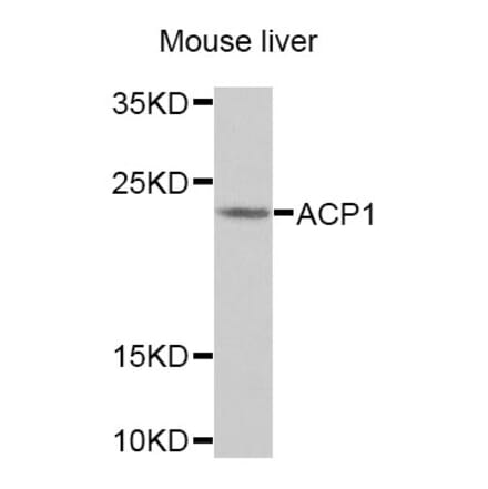 Anti-ACP1 Antibody from Bioworld Technology (BS7686) - Antibodies.com