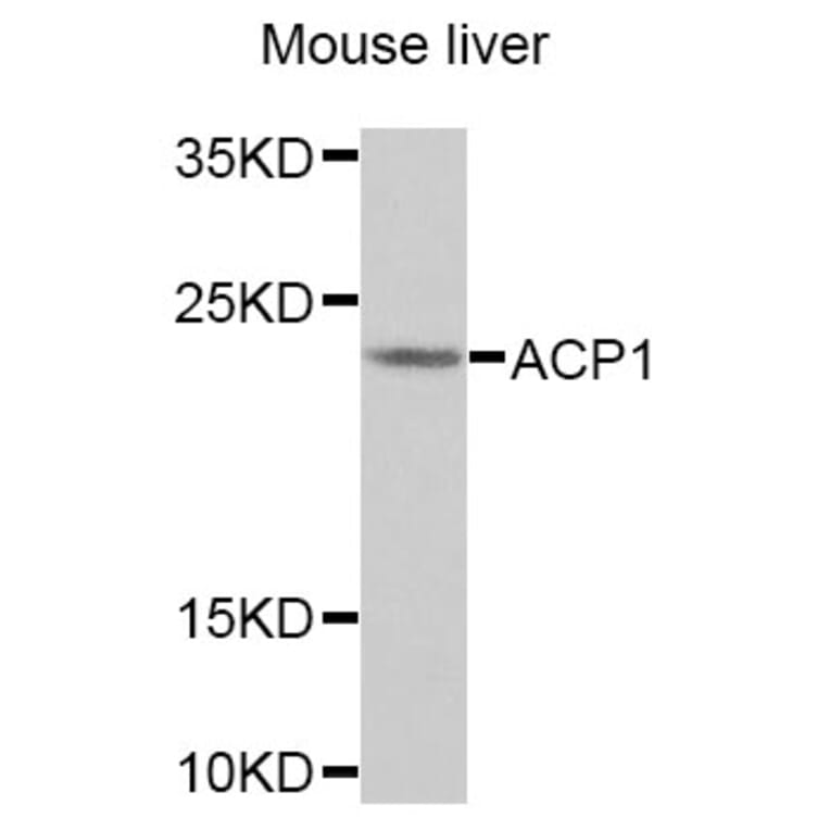 Anti-ACP1 Antibody from Bioworld Technology (BS7686) - Antibodies.com