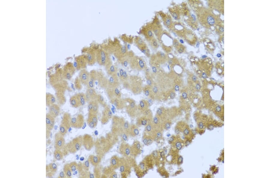 Anti-ACP1 Antibody from Bioworld Technology (BS7686) - Antibodies.com