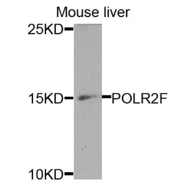 Anti-POLR2F Antibody from Bioworld Technology (BS7688) - Antibodies.com