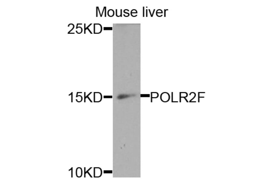 Anti-POLR2F Antibody from Bioworld Technology (BS7688) - Antibodies.com