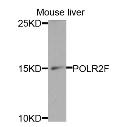 Anti-POLR2F Antibody from Bioworld Technology (BS7688) - Antibodies.com