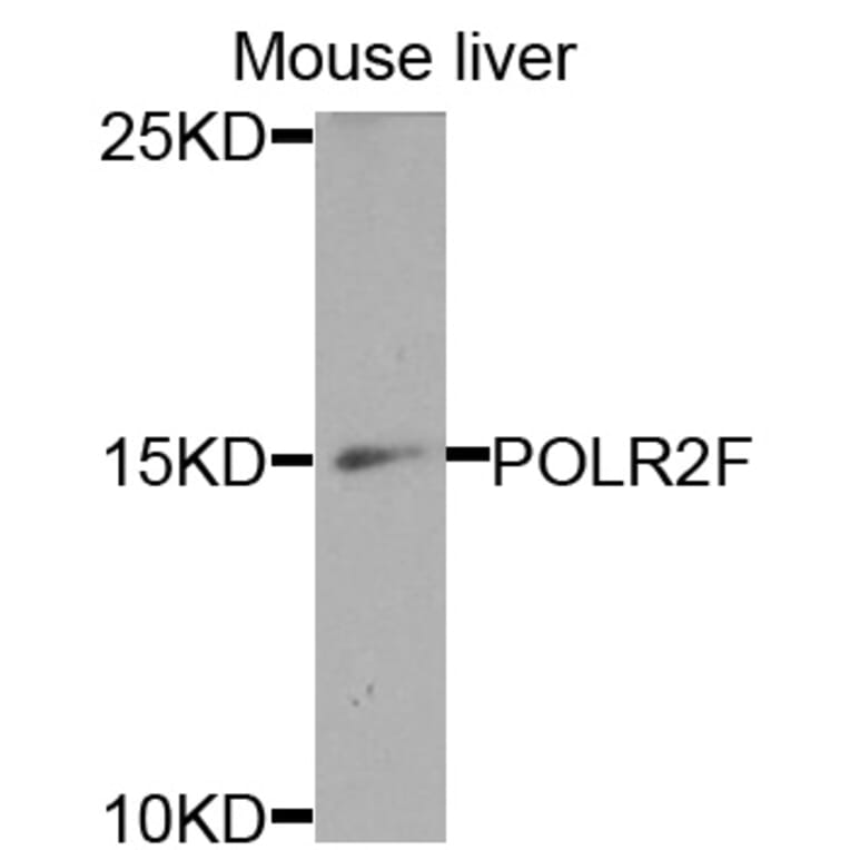 Anti-POLR2F Antibody from Bioworld Technology (BS7688) - Antibodies.com