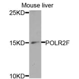 Anti-POLR2F Antibody from Bioworld Technology (BS7688) - Antibodies.com