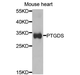 Anti-PTGDS Antibody from Bioworld Technology (BS7694) - Antibodies.com