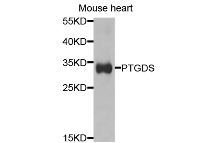 Anti-PTGDS Antibody from Bioworld Technology (BS7694) - Antibodies.com