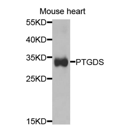 Anti-PTGDS Antibody from Bioworld Technology (BS7694) - Antibodies.com