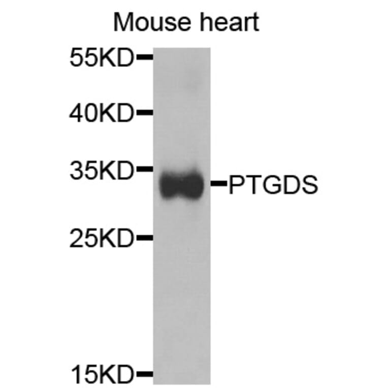 Anti-PTGDS Antibody from Bioworld Technology (BS7694) - Antibodies.com