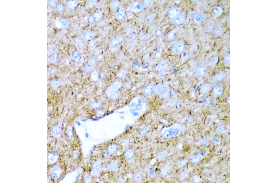Anti-PTGDS Antibody from Bioworld Technology (BS7694) - Antibodies.com