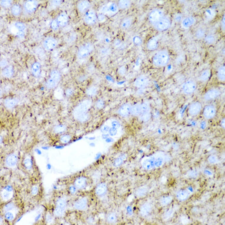 Anti-PTGDS Antibody from Bioworld Technology (BS7694) - Antibodies.com