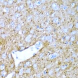 Anti-PTGDS Antibody from Bioworld Technology (BS7694) - Antibodies.com
