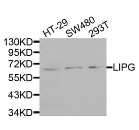 Anti-LIPG Antibody from Bioworld Technology (BS7695) - Antibodies.com