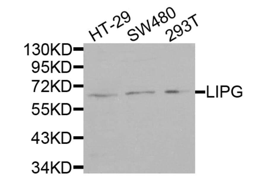 Anti-LIPG Antibody from Bioworld Technology (BS7695) - Antibodies.com