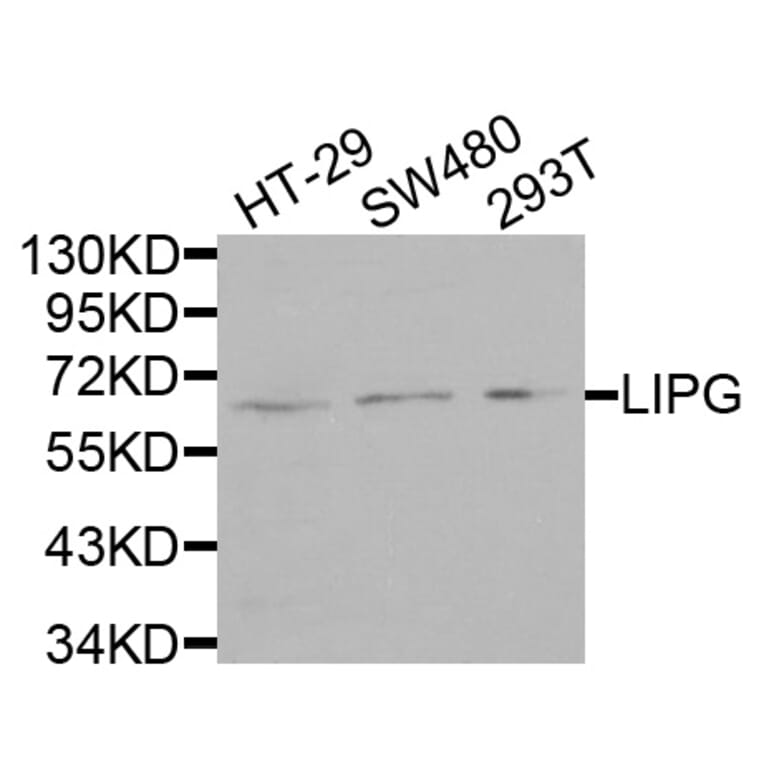 Anti-LIPG Antibody from Bioworld Technology (BS7695) - Antibodies.com