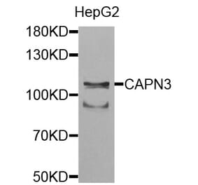 Anti-CAPN3 Antibody from Bioworld Technology (BS7696) - Antibodies.com