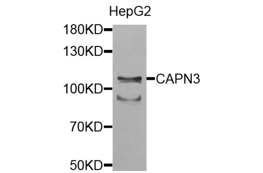 Anti-CAPN3 Antibody from Bioworld Technology (BS7696) - Antibodies.com