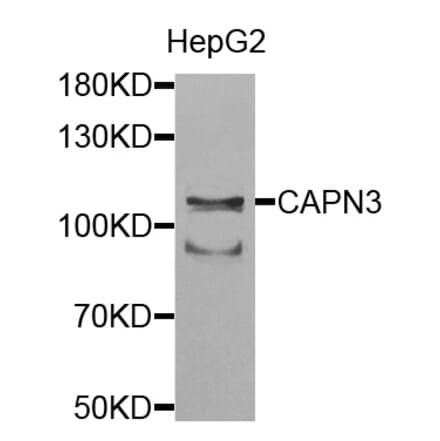 Anti-CAPN3 Antibody from Bioworld Technology (BS7696) - Antibodies.com