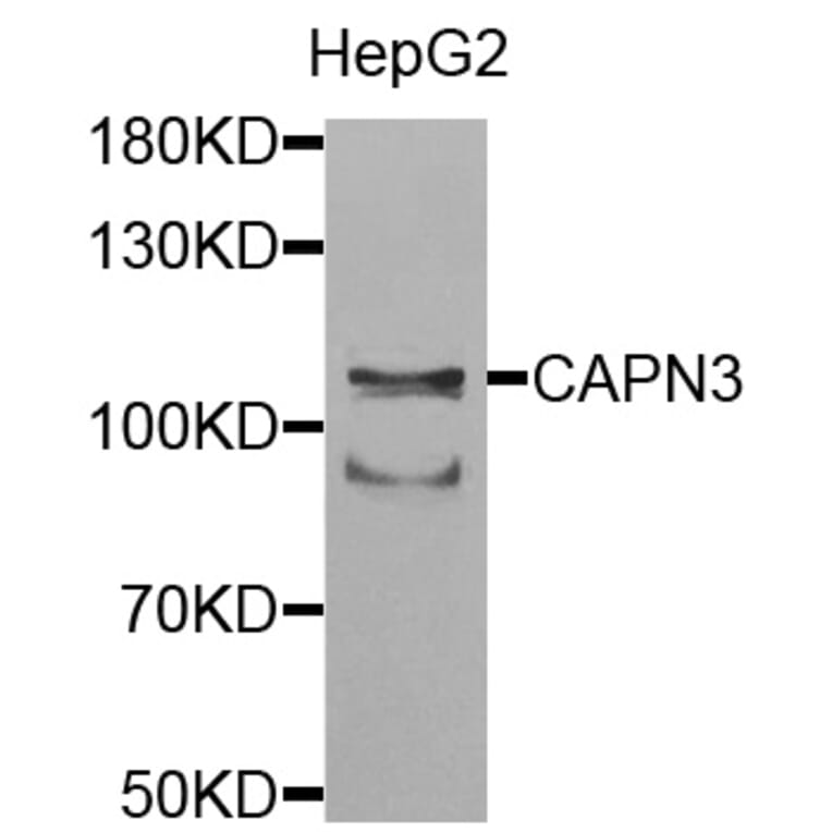 Anti-CAPN3 Antibody from Bioworld Technology (BS7696) - Antibodies.com