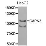 Anti-CAPN3 Antibody from Bioworld Technology (BS7696) - Antibodies.com