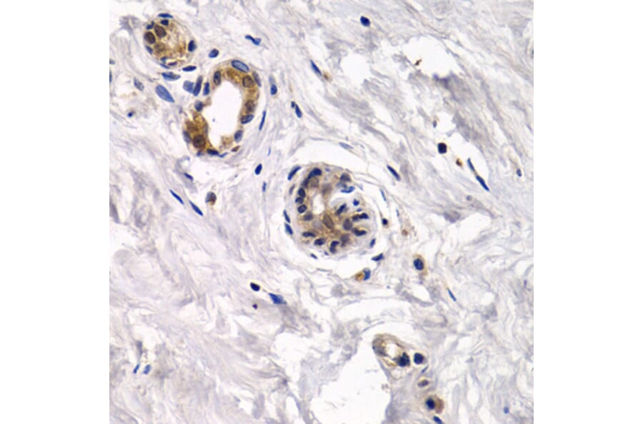 Anti-CAPN3 Antibody from Bioworld Technology (BS7696) - Antibodies.com