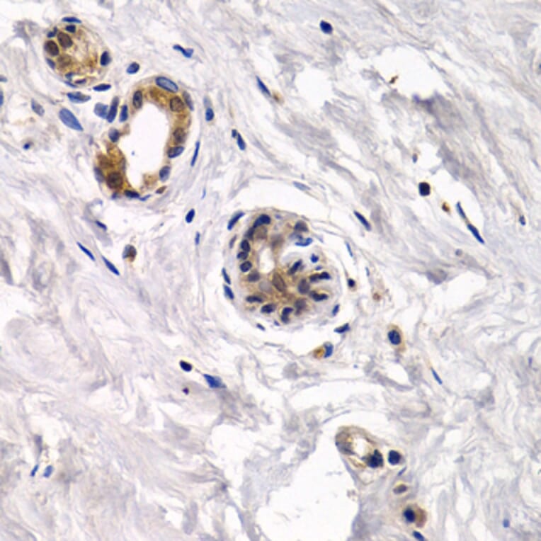 Anti-CAPN3 Antibody from Bioworld Technology (BS7696) - Antibodies.com