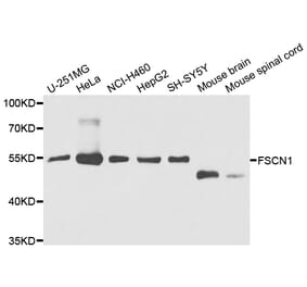 Anti-FSCN1 Antibody from Bioworld Technology (BS7700) - Antibodies.com