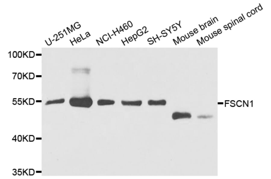 Anti-FSCN1 Antibody from Bioworld Technology (BS7700) - Antibodies.com