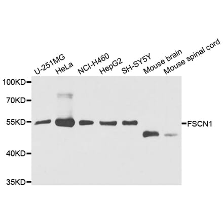 Anti-FSCN1 Antibody from Bioworld Technology (BS7700) - Antibodies.com