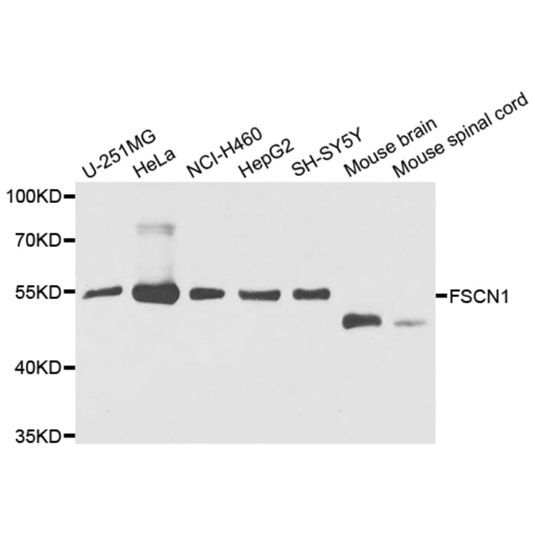 Anti-FSCN1 Antibody from Bioworld Technology (BS7700) - Antibodies.com