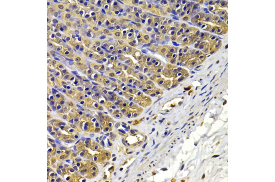 Anti-FSCN1 Antibody from Bioworld Technology (BS7700) - Antibodies.com