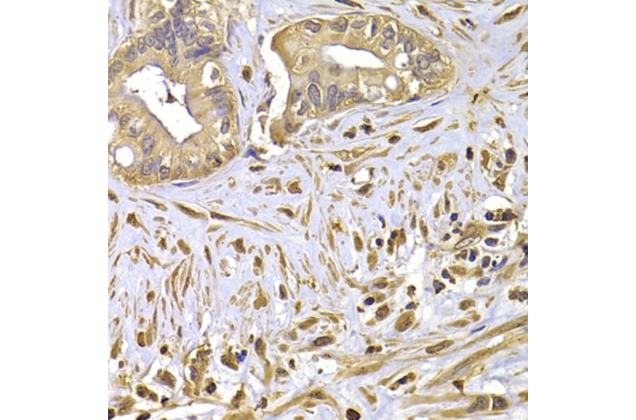 Anti-FSCN1 Antibody from Bioworld Technology (BS7700) - Antibodies.com