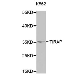 Anti-TIRAP Antibody from Bioworld Technology (BS7705) - Antibodies.com