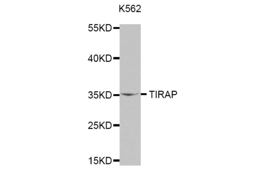 Anti-TIRAP Antibody from Bioworld Technology (BS7705) - Antibodies.com