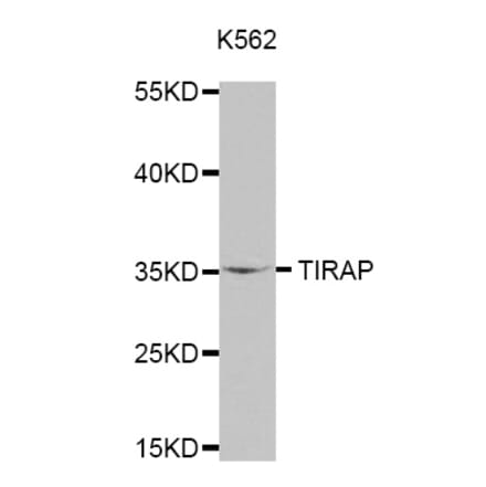 Anti-TIRAP Antibody from Bioworld Technology (BS7705) - Antibodies.com