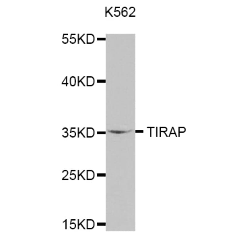 Anti-TIRAP Antibody from Bioworld Technology (BS7705) - Antibodies.com