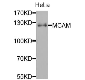 Anti-MCAM Antibody from Bioworld Technology (BS7708) - Antibodies.com